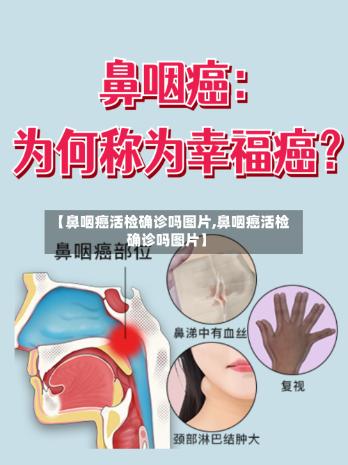 【鼻咽癌活检确诊吗图片,鼻咽癌活检确诊吗图片】-第2张图片