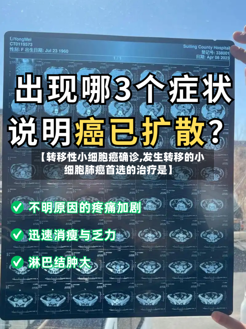 【转移性小细胞癌确诊,发生转移的小细胞肺癌首选的治疗是】-第2张图片
